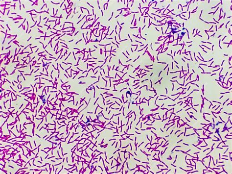 e coli capsule stain|e coli gram stain morphology.